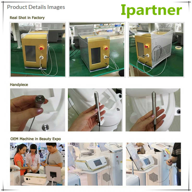 Laser de diodo Ipartner LS980 alivia o sistema de vermelhidão