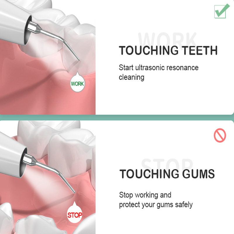 Uso doméstico Visualização Cálculo dental ultrassônico Câmera de alta definição e luz LED com 3 modos de limpeza de dentes