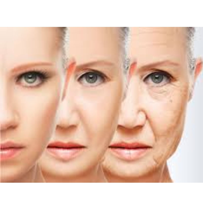 NR e NMN foram selecionadosno \\\\ \\\